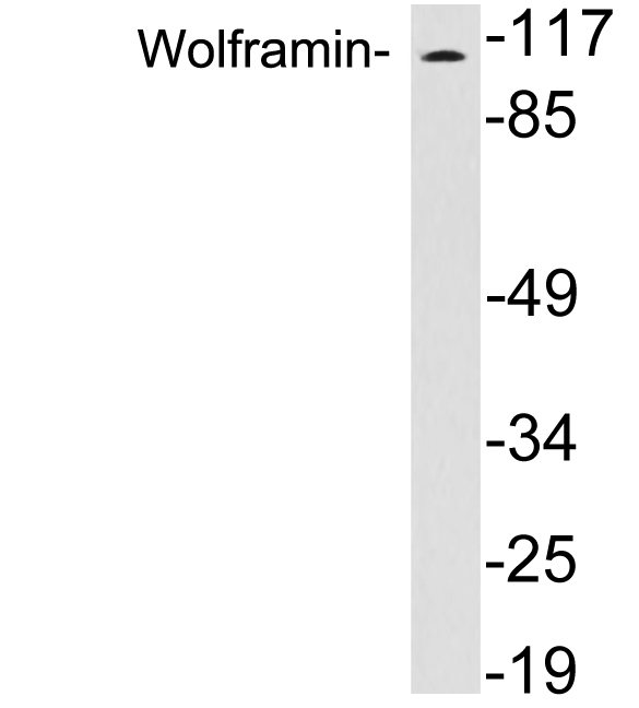 Anti-Wolframin Antibody