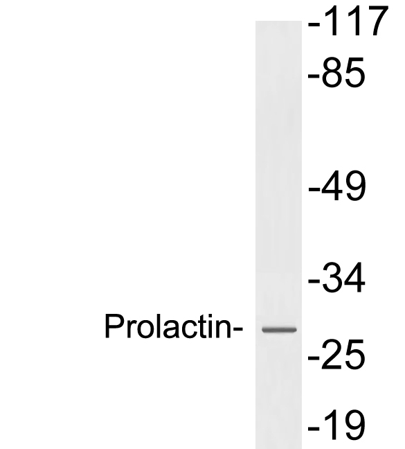 Anti-Prolactin Antibody