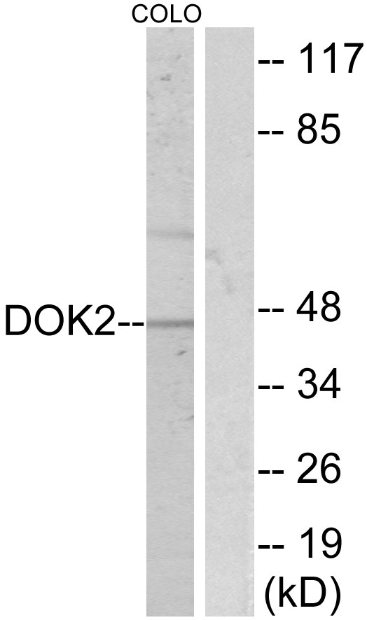 Anti-p56 Dok-2 Antibody - Identical to Abcam (ab131488)