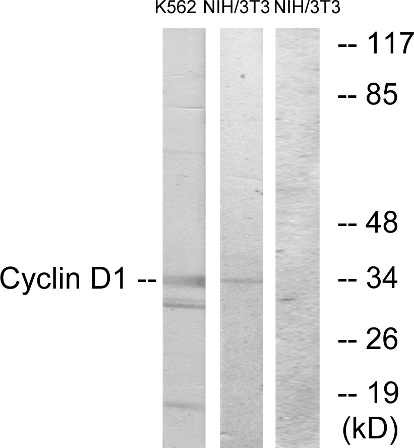 Anti-Cyclin D1 Antibody