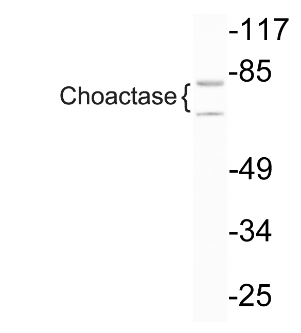 Anti-Choactase Antibody