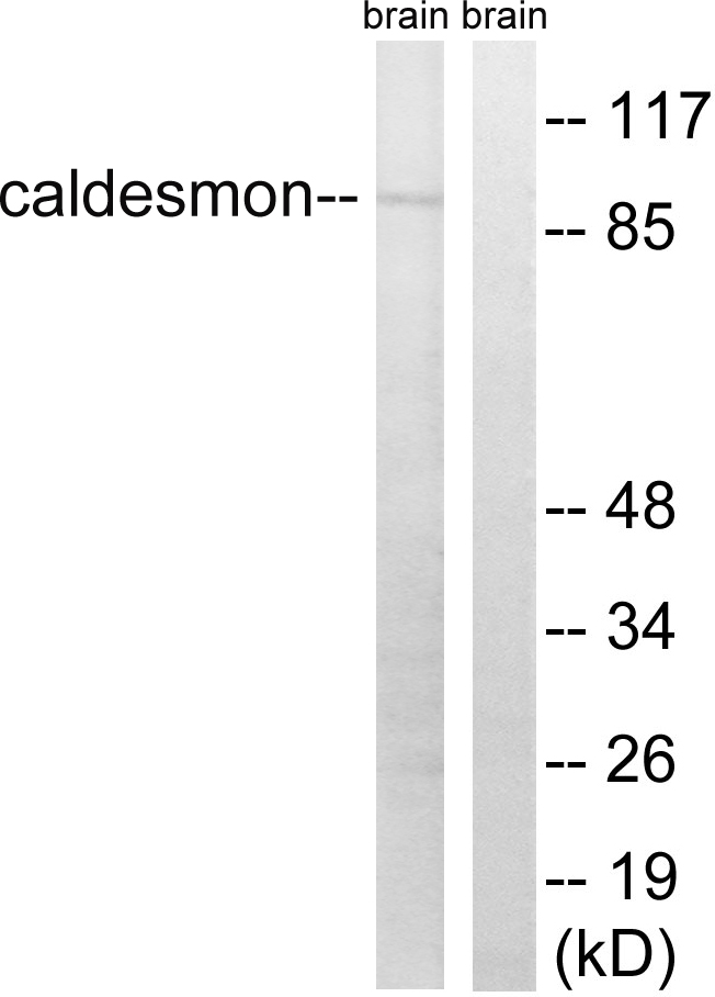 Anti-Caldesmon Antibody