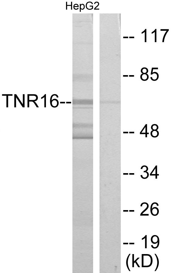 Anti-TNR16 Antibody