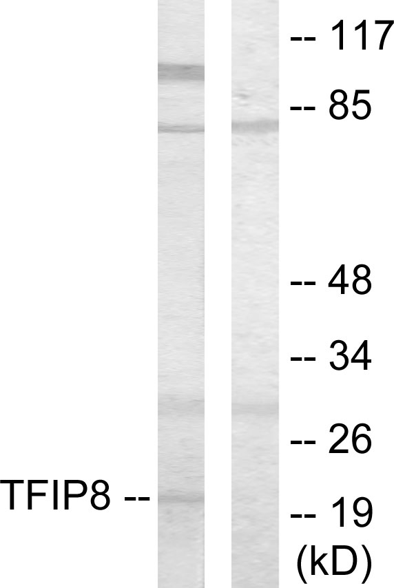 Anti-TFIP8 Antibody
