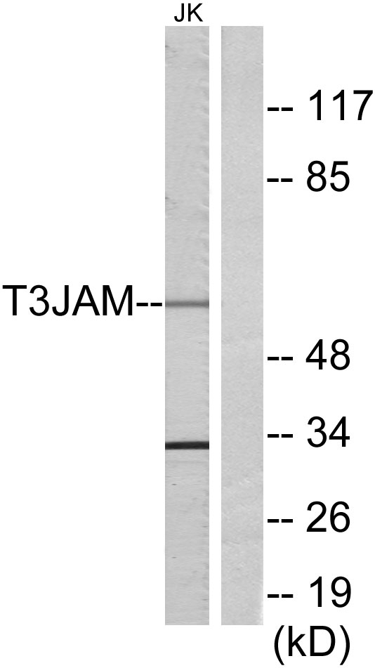 Anti-T3JAM Antibody