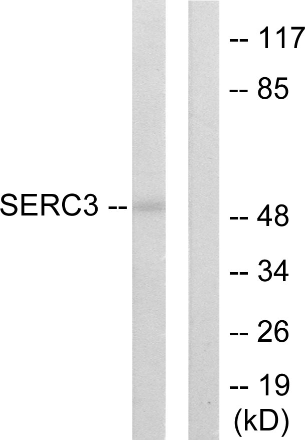 Anti-SERC3 Antibody