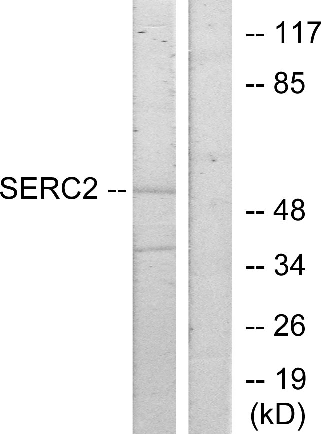 Anti-SERC2 Antibody