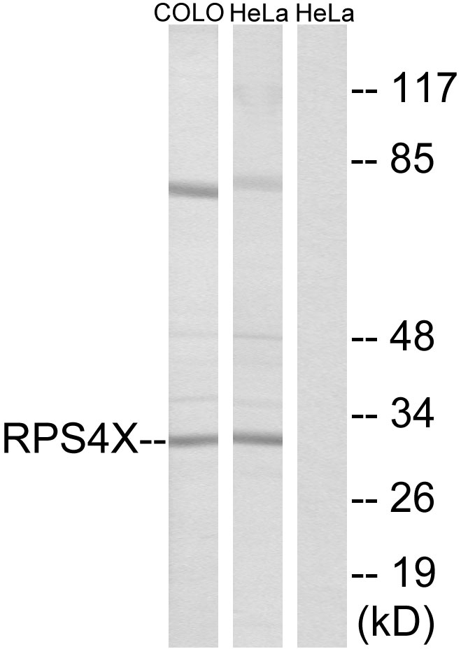 Anti-RPS4X Antibody - Identical to Abcam (ab211427)