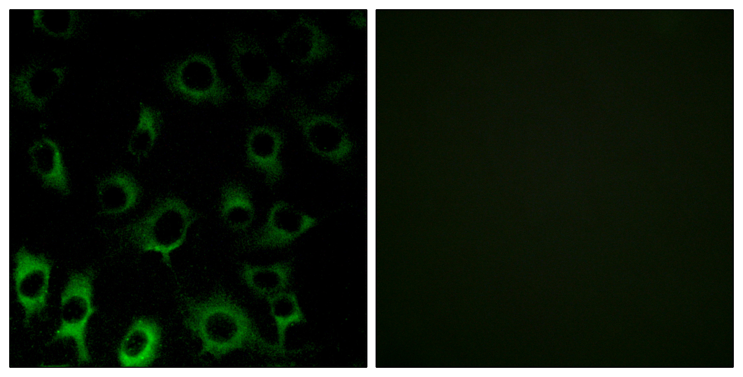 Anti-RPS4X Antibody - Identical to Abcam (ab211427) Anti-RPS4X Antibody - Identical to Abcam (ab211427)