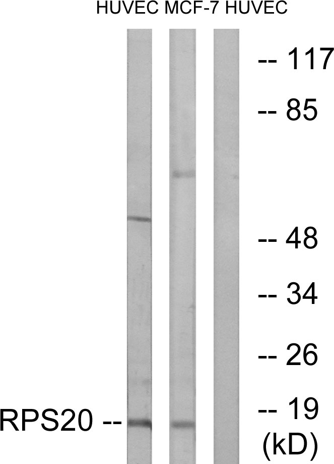 Anti-RPS20 Antibody