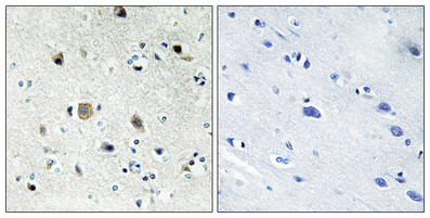 Anti-RPS20 Antibody Anti-RPS20 Antibody