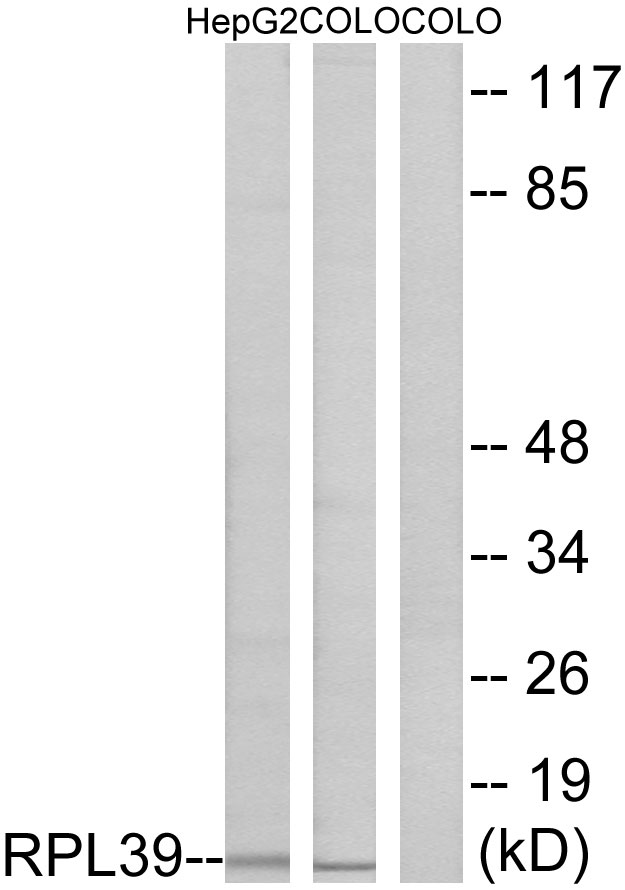 Anti-RPL39 Antibody - Identical to Abcam (ab74740)