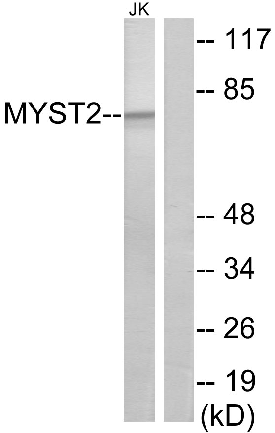 Anti-MYST2 Antibody - Identical to Abcam (ab70183)