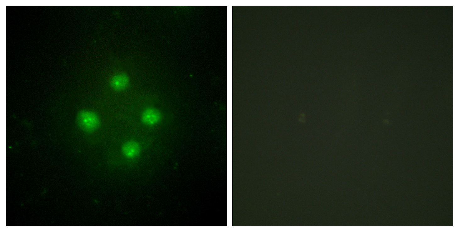 Anti-MED24 Antibody Anti-MED24 Antibody