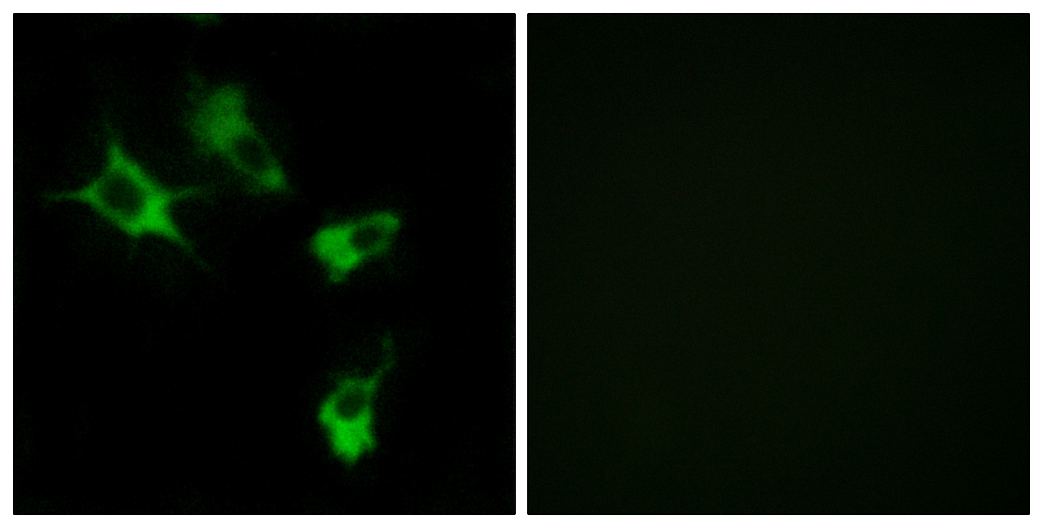 Anti-MAST4 Antibody - Identical to Abcam (ab196777)