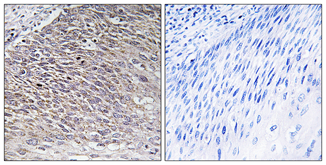 Anti-MAST4 Antibody - Identical to Abcam (ab196777) Anti-MAST4 Antibody - Identical to Abcam (ab196777)
