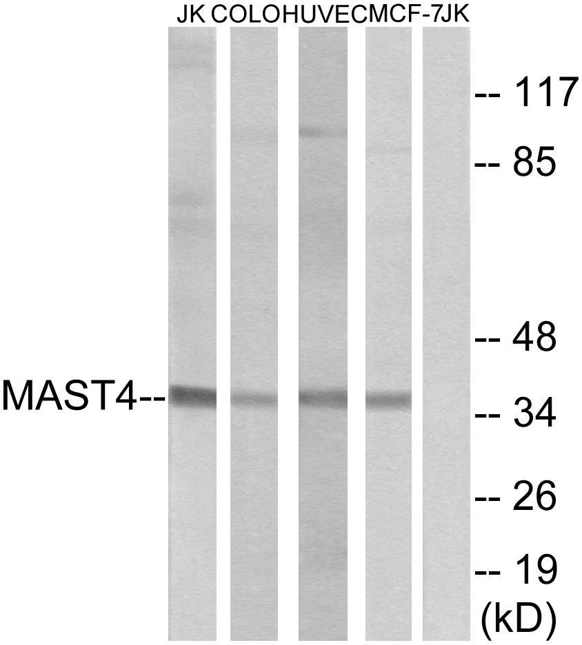 Anti-MAST4 Antibody - Identical to Abcam (ab196777) Anti-MAST4 Antibody - Identical to Abcam (ab196777)