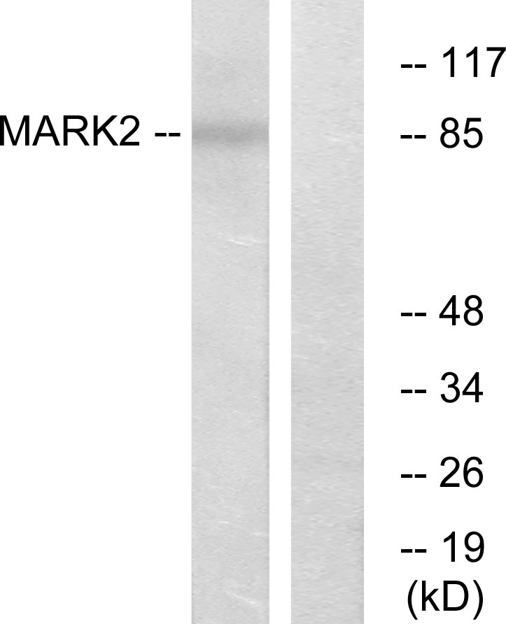 Anti-MARK2 Antibody - Identical to Abcam (ab136872)