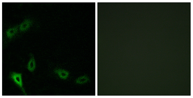 Anti-MARK2 Antibody - Identical to Abcam (ab136872) Anti-MARK2 Antibody - Identical to Abcam (ab136872)