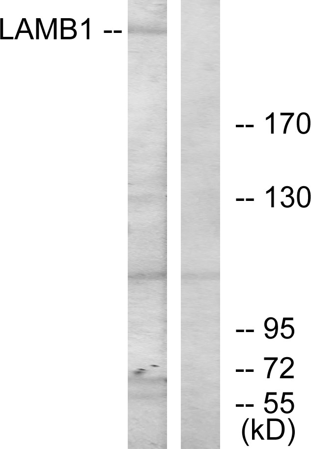 Anti-LAMB1 Antibody - Identical to Abcam (ab69633)