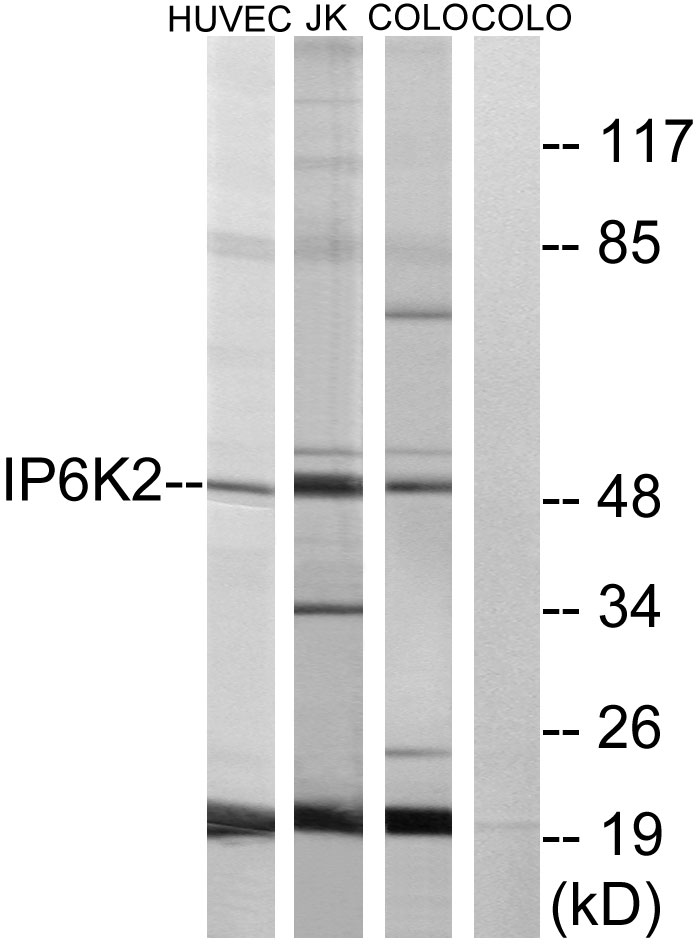 Anti-IP6K2 Antibody - Identical to Abcam (ab179921)
