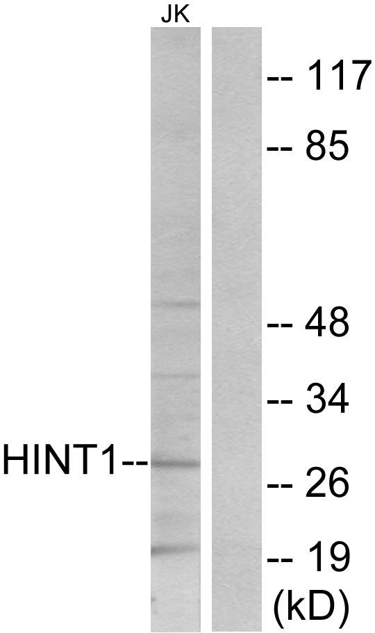 Anti-HINT1 Antibody