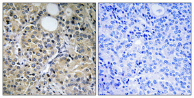 Anti-HINT1 Antibody Anti-HINT1 Antibody
