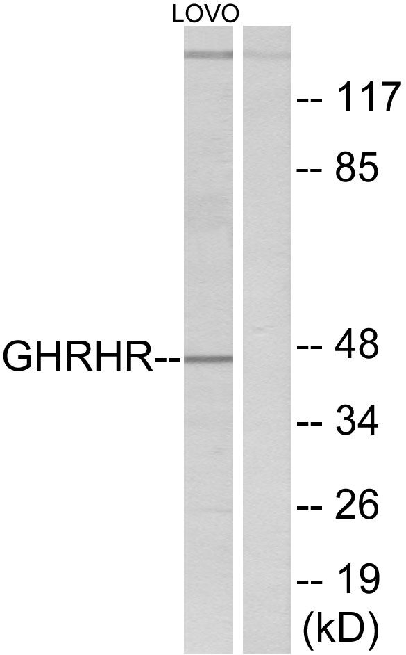 Anti-GHRHR Antibody - Identical to Abcam (ab76263)