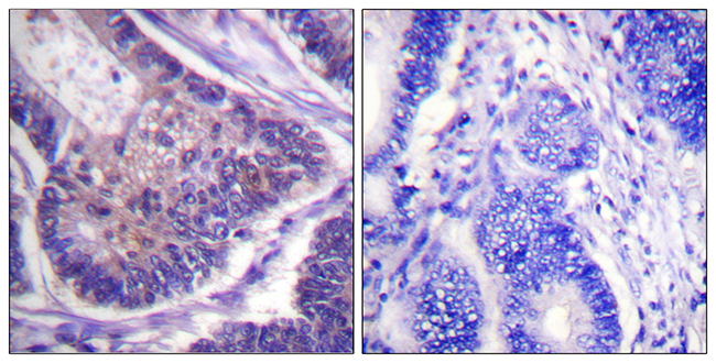 Anti-eIF4B Antibody Anti-eIF4B Antibody