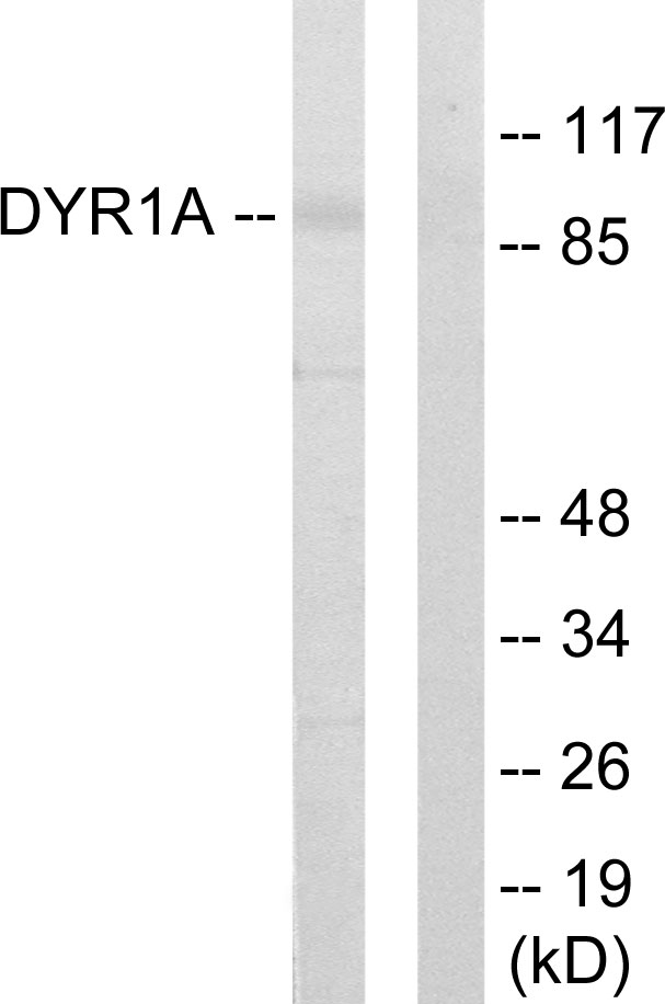 Anti-DYR1A Antibody - Identical to Abcam (ab65220)
