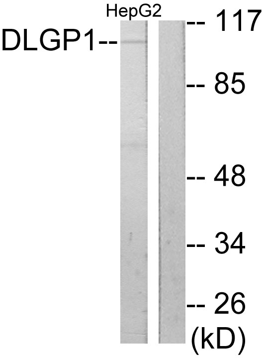 Anti-DLGP1 Antibody