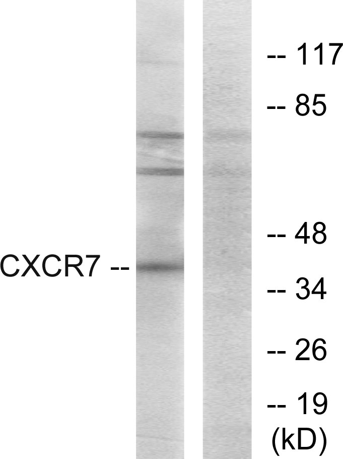 Anti-CXCR7 Antibody - Identical to Abcam (ab113410)