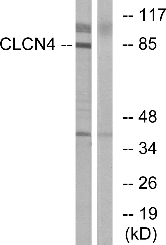 Anti-CLCN4 Antibody