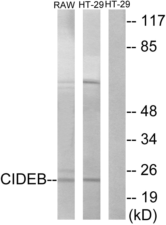 Anti-CIDEB Antibody - Identical to Abcam (ab196595)