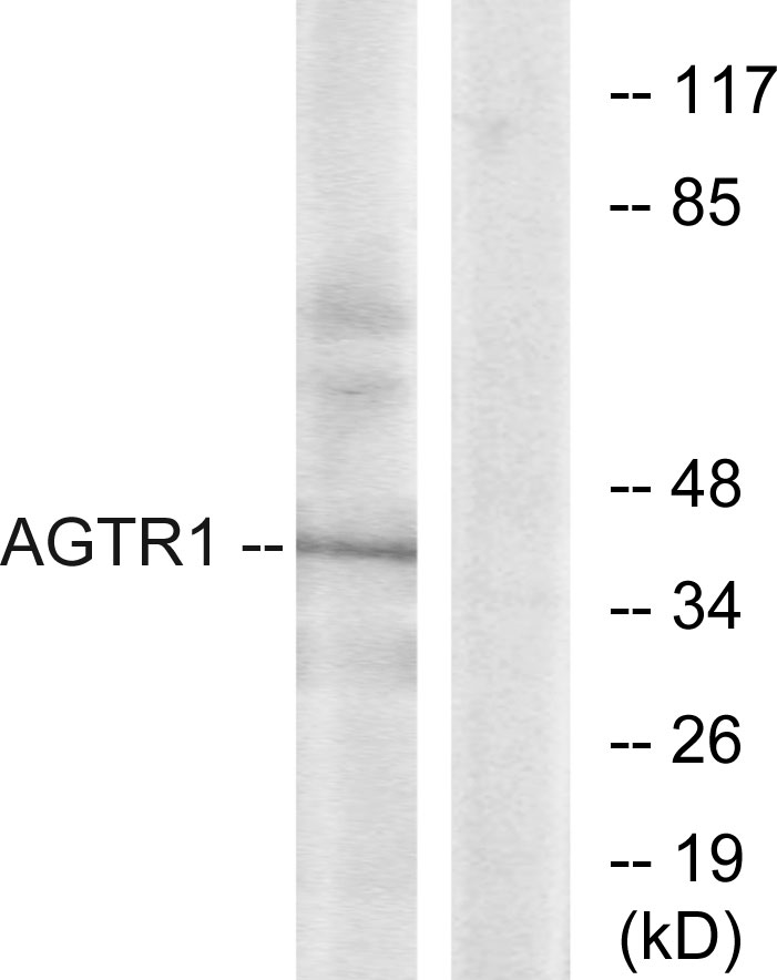 Anti-AGTR1 Antibody