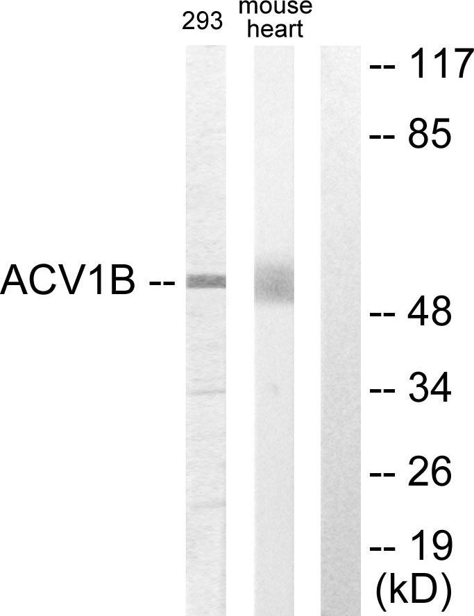Anti-ACV1B Antibody