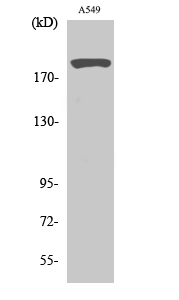 Anti-53BP1 Antibody Anti-53BP1 Antibody