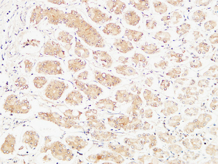 Anti-TNFA Antibody Anti-TNFA Antibody