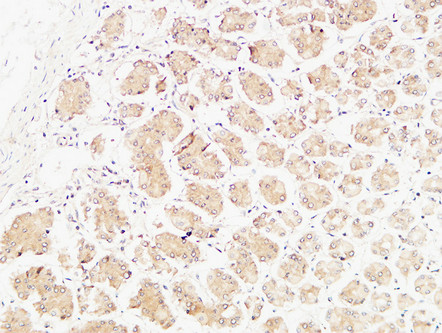 Anti-TNFA Antibody Anti-TNFA Antibody