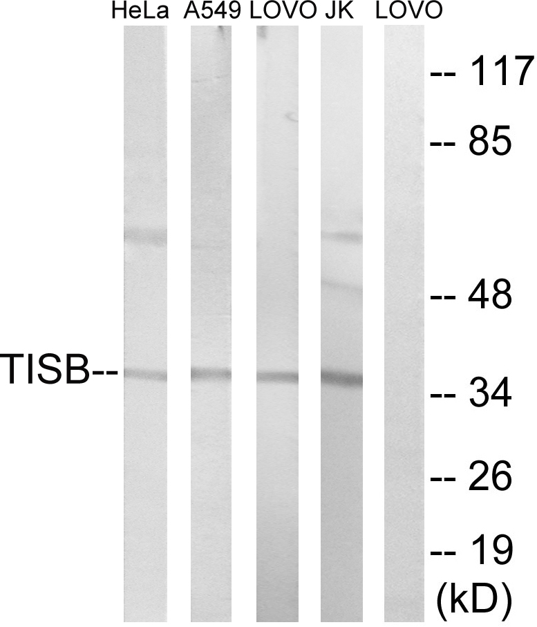 Anti-TISB Antibody