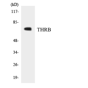 Anti-THRB Antibody