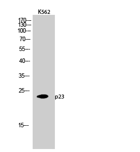 Anti-TEBP Antibody Anti-TEBP Antibody