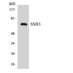Anti-SSH3 Antibody