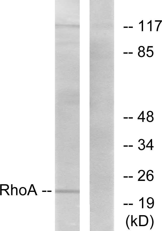 Anti-RhoA Antibody