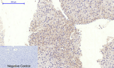 Anti-RhoA Antibody Anti-RhoA Antibody