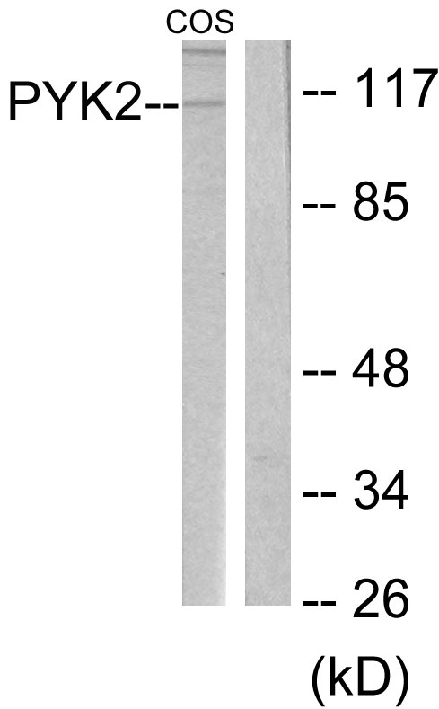 Anti-PYK2 Antibody