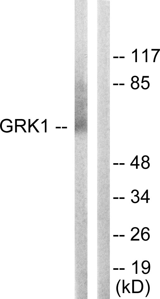 Anti-GRK1 Antibody