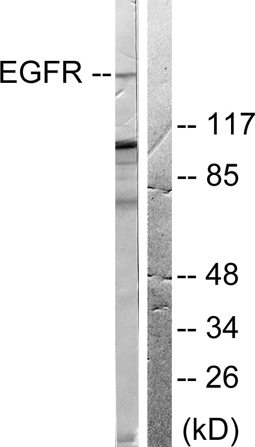 Anti-EGFR Antibody