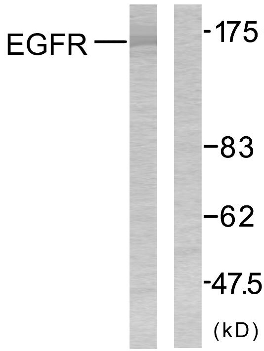 Anti-EGFR Antibody Anti-EGFR Antibody