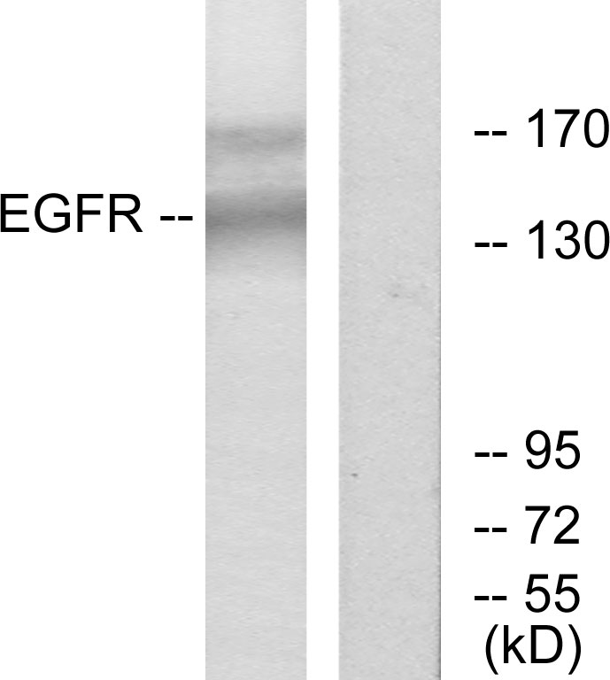Anti-EGFR Antibody